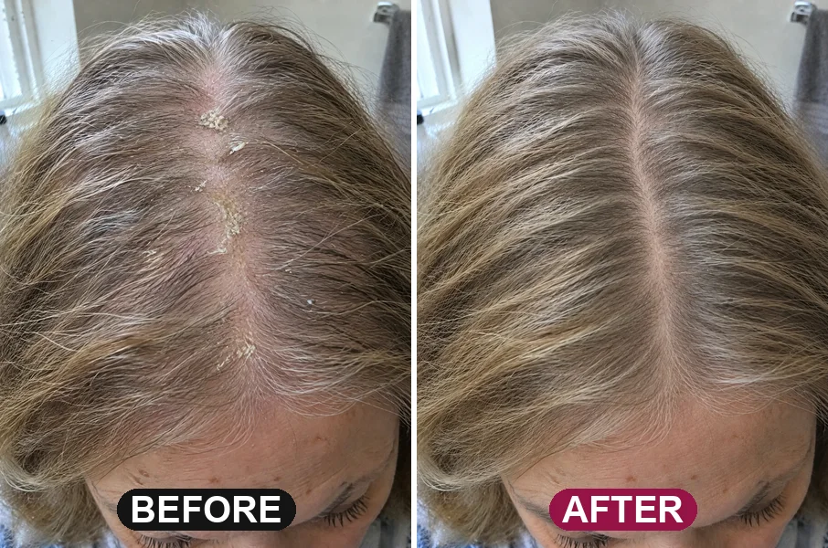 Before: a part line coated in greasy buildup and flakes. After: the same part, clean down to the scalp